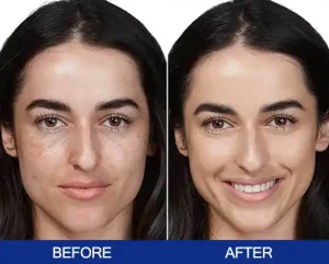 2025 Picosecond Laser Technology