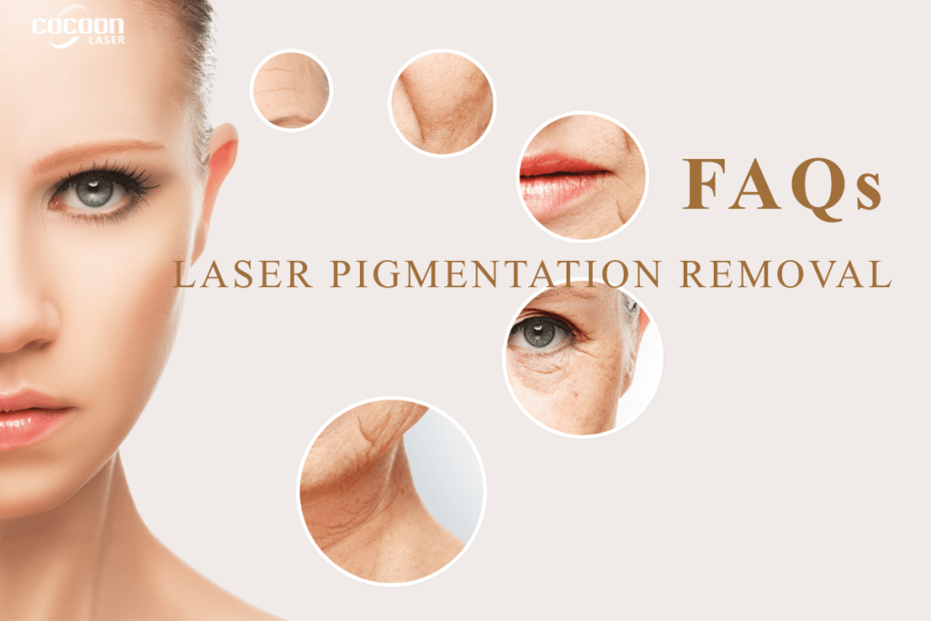 Laser pigmentation removal FAQs