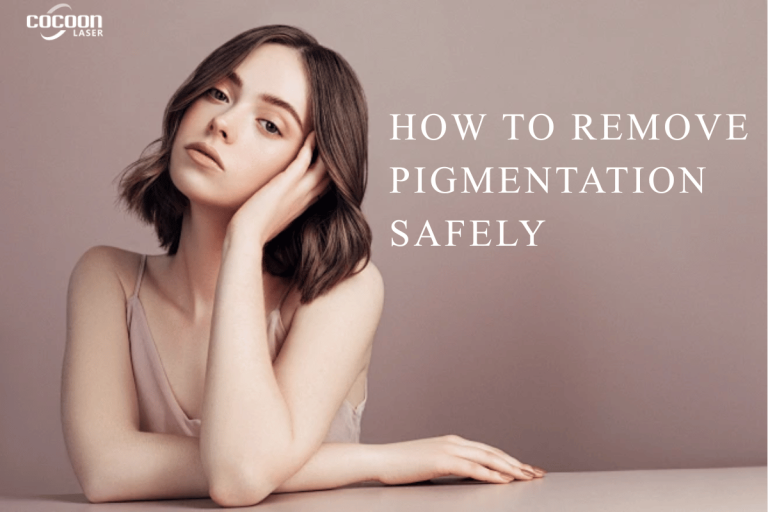 How to Remove Pigmentation Safely