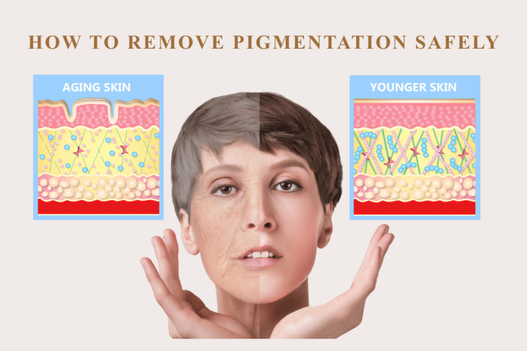 How to Remove Pigmentation Safely