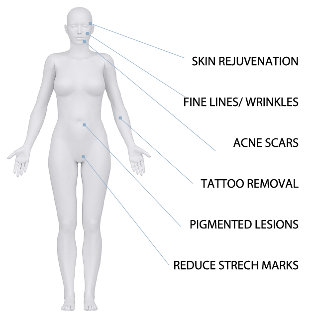 I-Cool Pico PURE | Cocoon Laser | 1 11