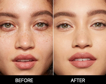 I-Cool Pico PURE | Cocoon Laser | 8 2