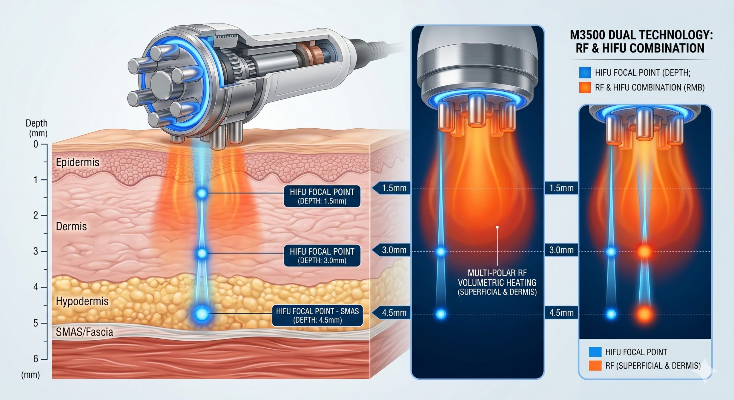 Professional Non-Invasive Face Lift Machine | 3rd Gen Multi-Wave RF & HIFU Synergy, Painless Facelift Technology scenario 3