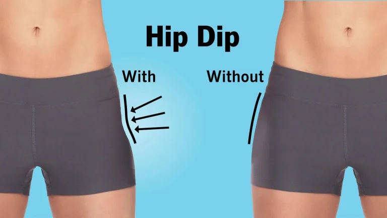 What Are Hip Dips? Causes, Anatomy & Why They Are Normal