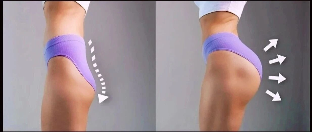 How to Get Rid of Hip Dips? | Cocoon Laser | how to get rid of hip dips