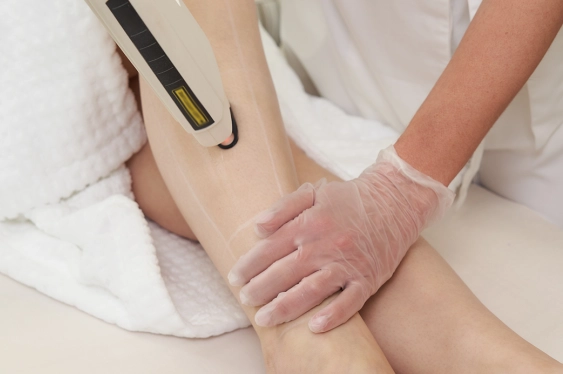 How Much Does a Professional Diode Laser Hair Removal Machine Cost?