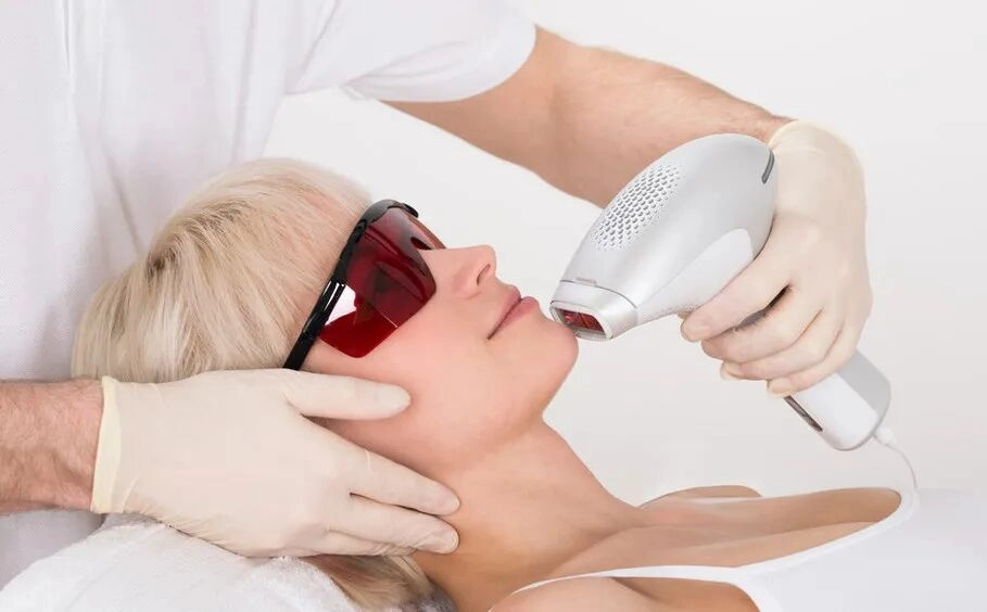 Professional diode laser hair removal machine used in aesthetic clinics
