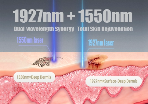 1927nm and 1550nm dual wavelength thulium laser technology comparison