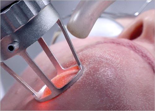 CO2 Laser Cost: Price Guide for Clinics | Cocoon Laser | co2 laser cost