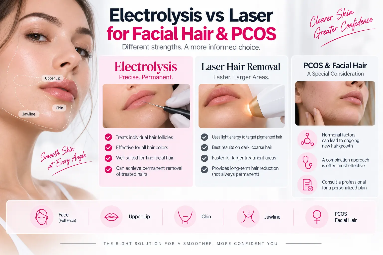 Electrolysis vs laser hair removal for face chin upper lip and PCOS