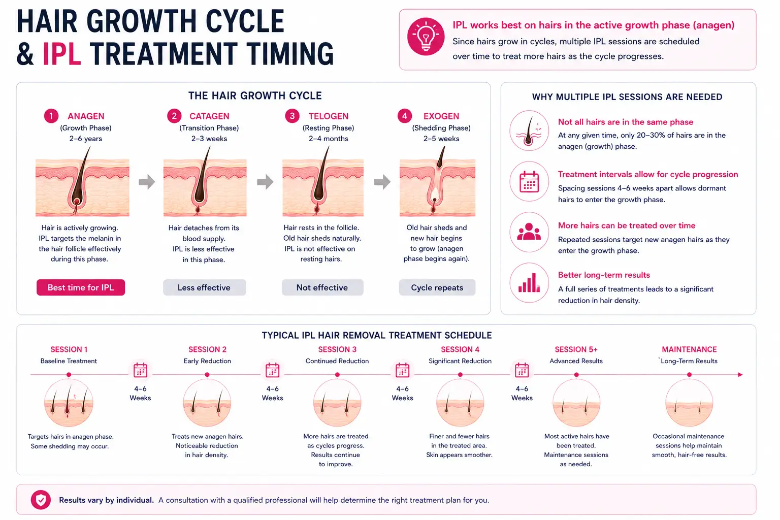 Hair growth cycle and IPL hair removal treatment timing