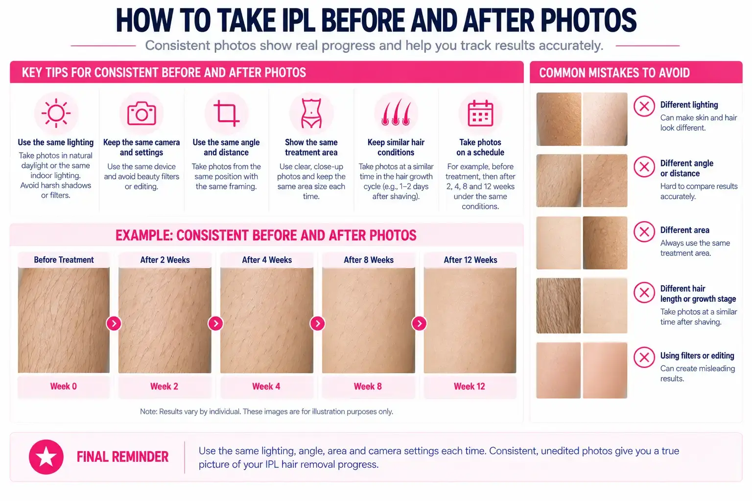 How to take consistent IPL hair removal before and after photos