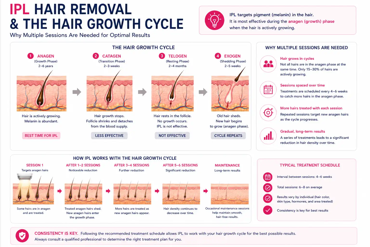 IPL hair removal and the anagen catagen telogen hair growth cycle