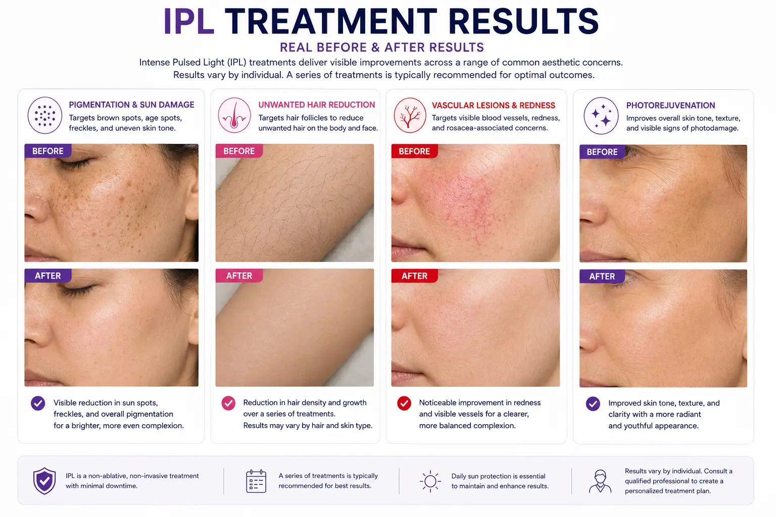 IPL treatment results and before and after changes for pigmentation hair and photorejuvenation