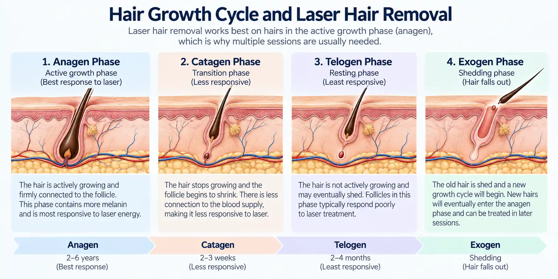 Diagram of anagen, catagen and telogen hair growth phases explaining why bikini laser hair removal requires multiple sessions