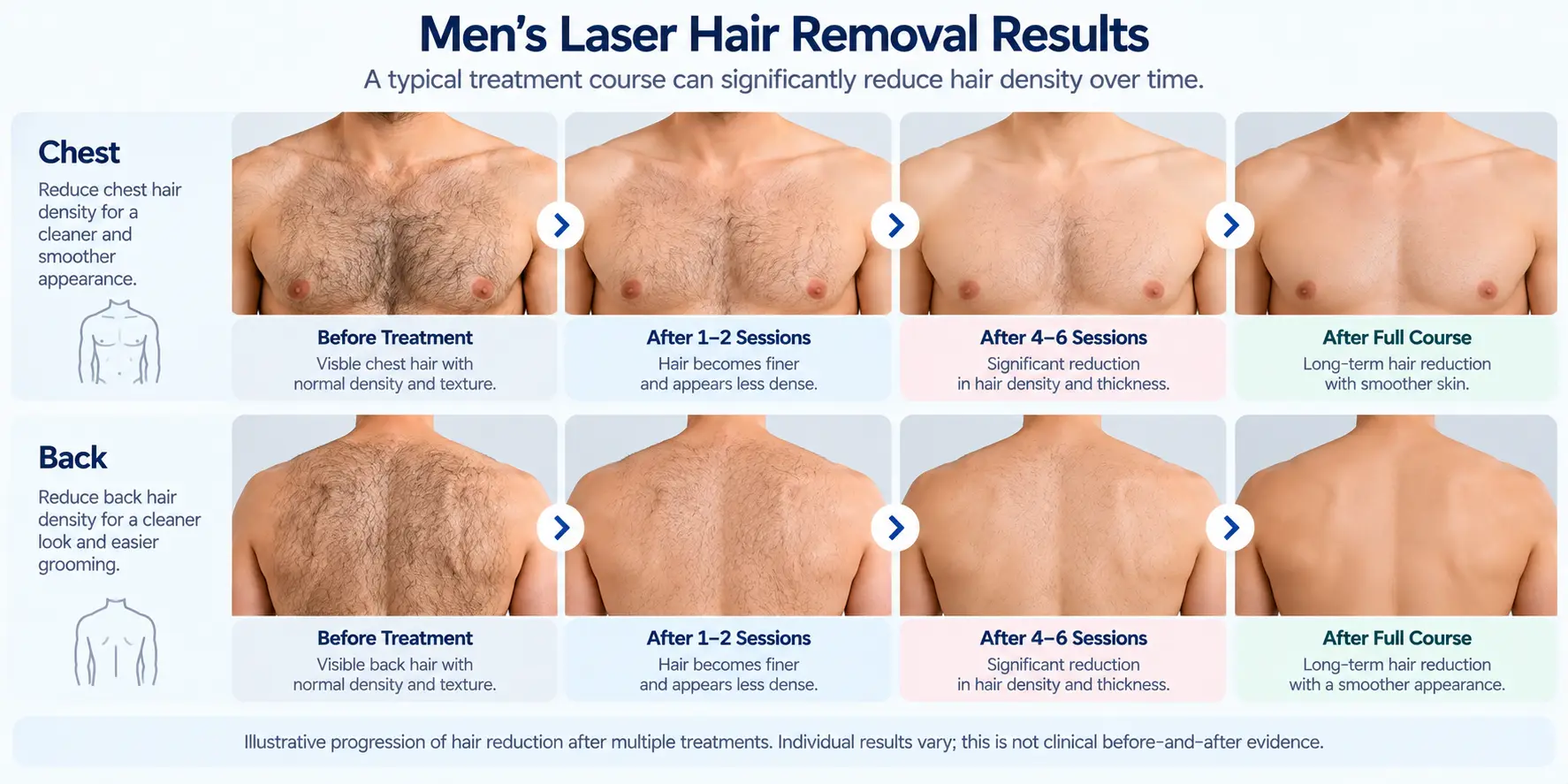 Laser Hair Removal for Men: Cost, Pain & Results (2026) | Cocoon Laser | mens laser hair removal results